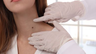 افضل دكتور جلدية بالكويت لعلاج جميع مشاكل وأمراض الجلد والبشرة